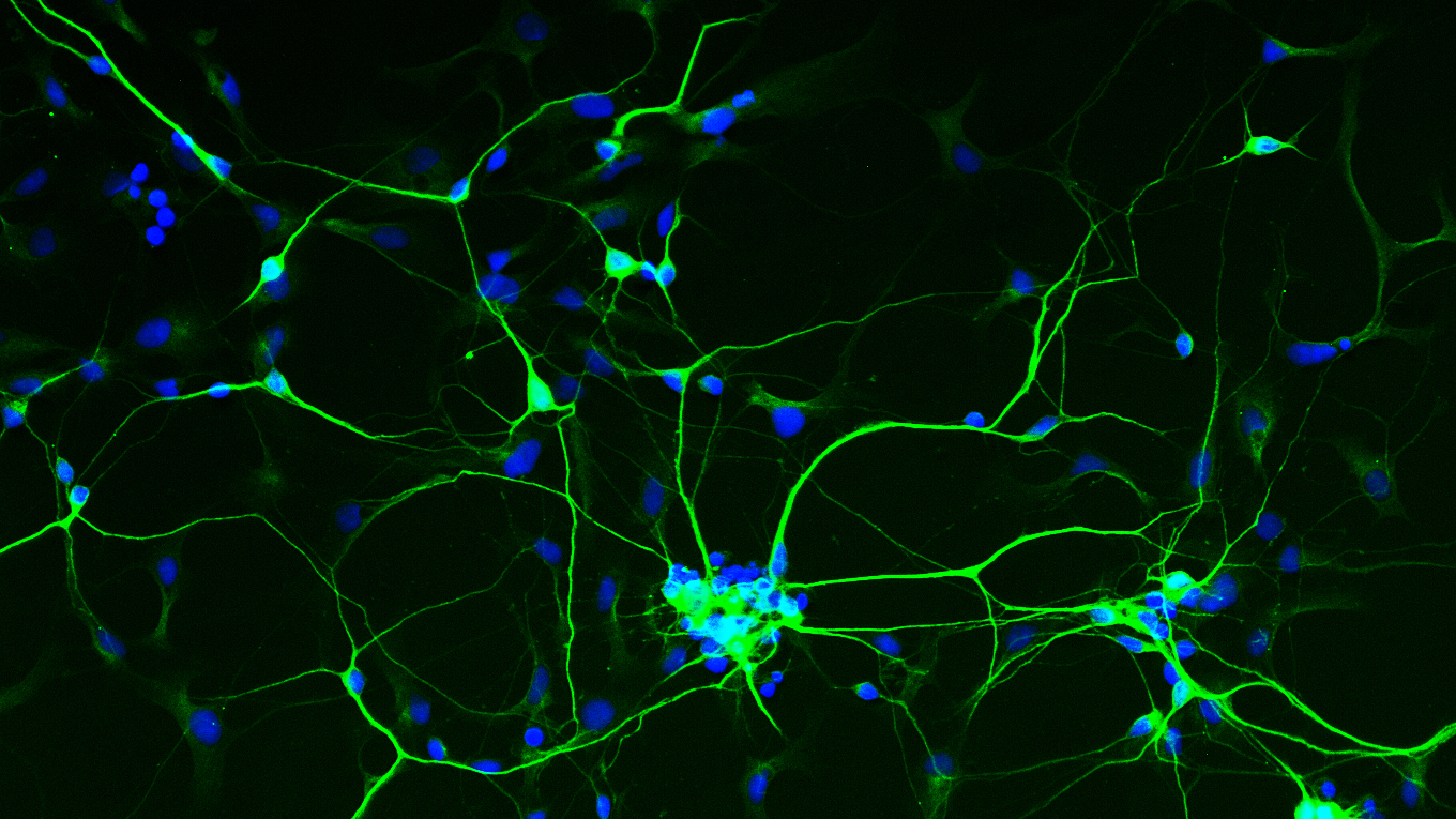 human brain neurons created from skin cells